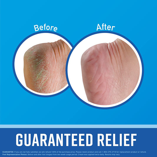 for Healthy Feet Foot Cream; Guaranteed Relief for Extremely Dry; Cracked Feet; Instantly Boosts Moisture Levels; 3.2 Ounce Jar; (Pack of 3)
