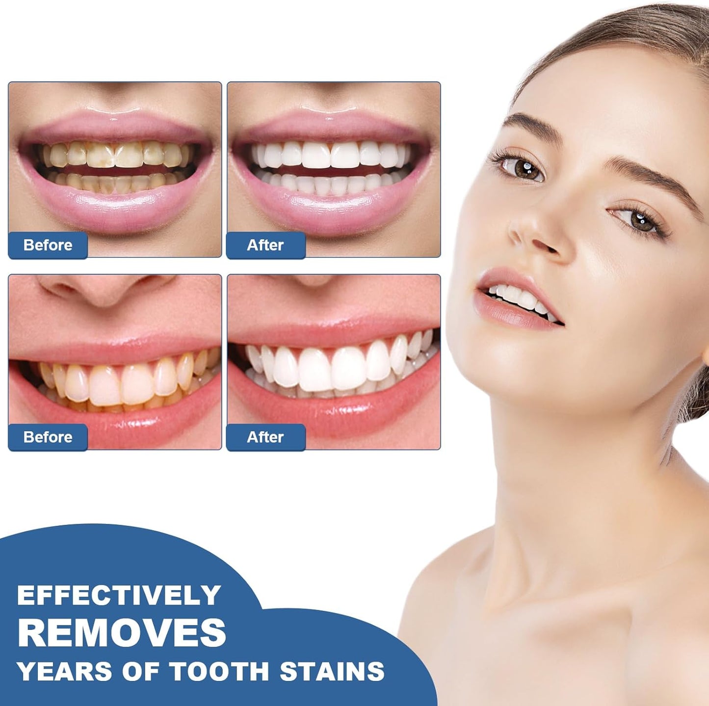 Teeth Whitening Pen,Teeth Whitening Essence,Teeth Whitening Gel,Teeth Stain Remover to Whiten Teeth,Intensive Stain Removal Teeth Reduce Yellowing (2Pcs)